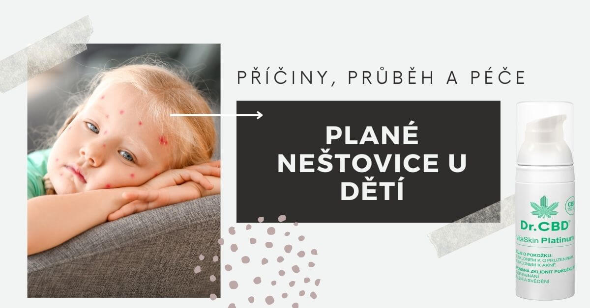 Plané neštovice