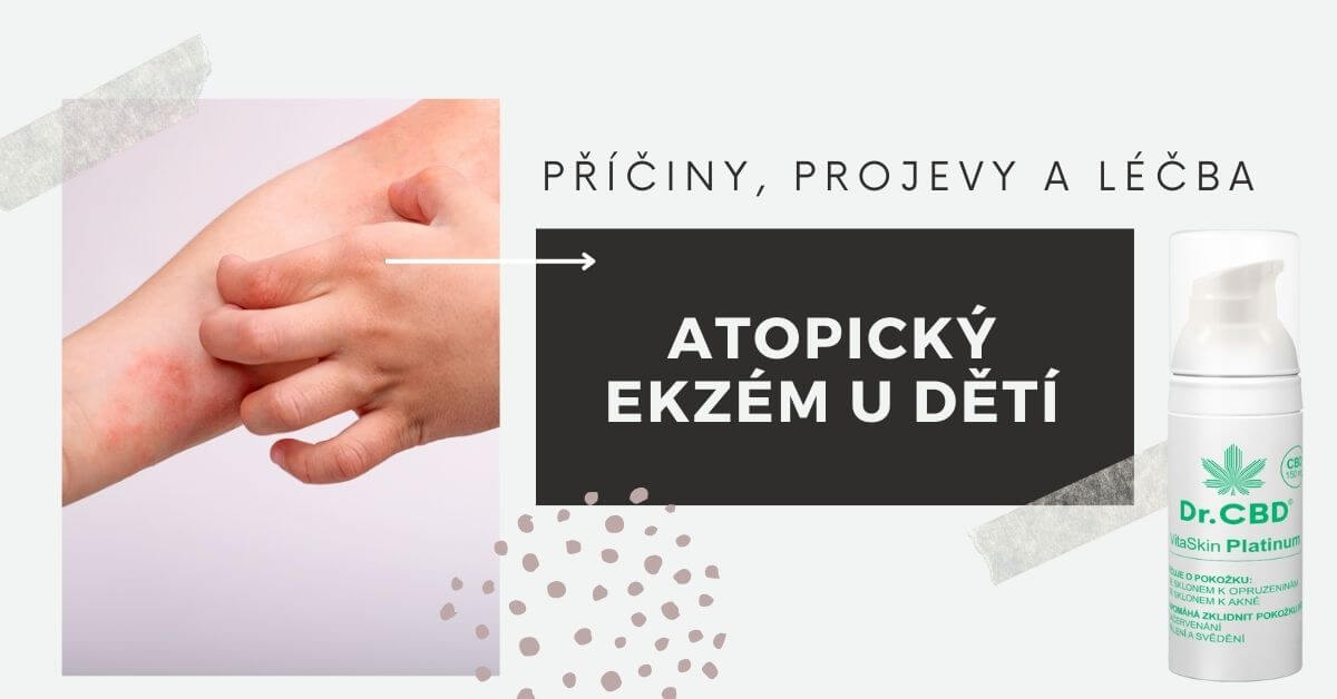 Atopický ekzém u dětí