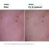 P-Tiox cream