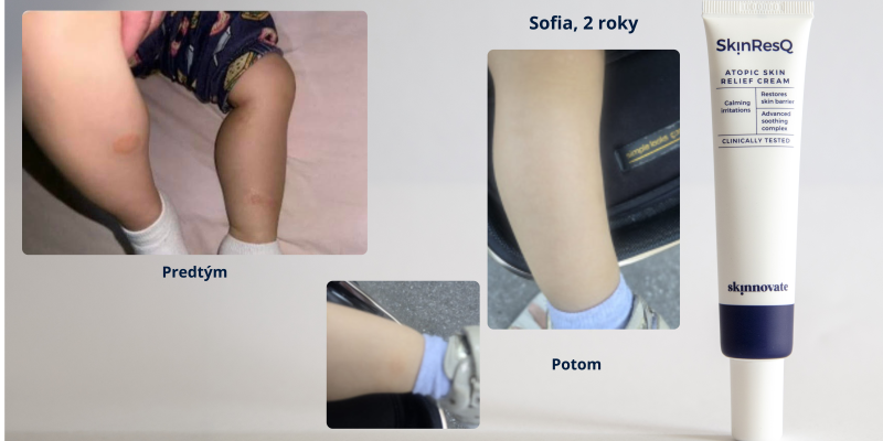 Sofia (2 roky)