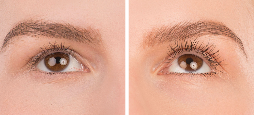 Sérum hairPLUS skutočne funguje