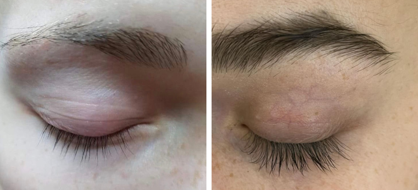 Sérum hairPLUS je pre mňa MUST HAVE!