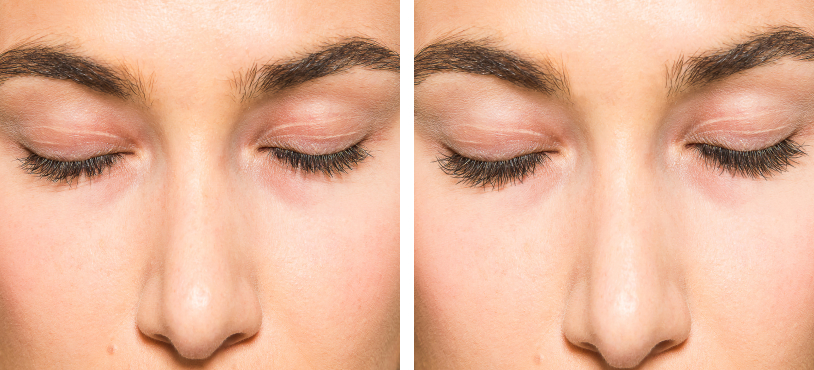 hairPLUS používam od 6 týždňov a výsledky sú úžasné