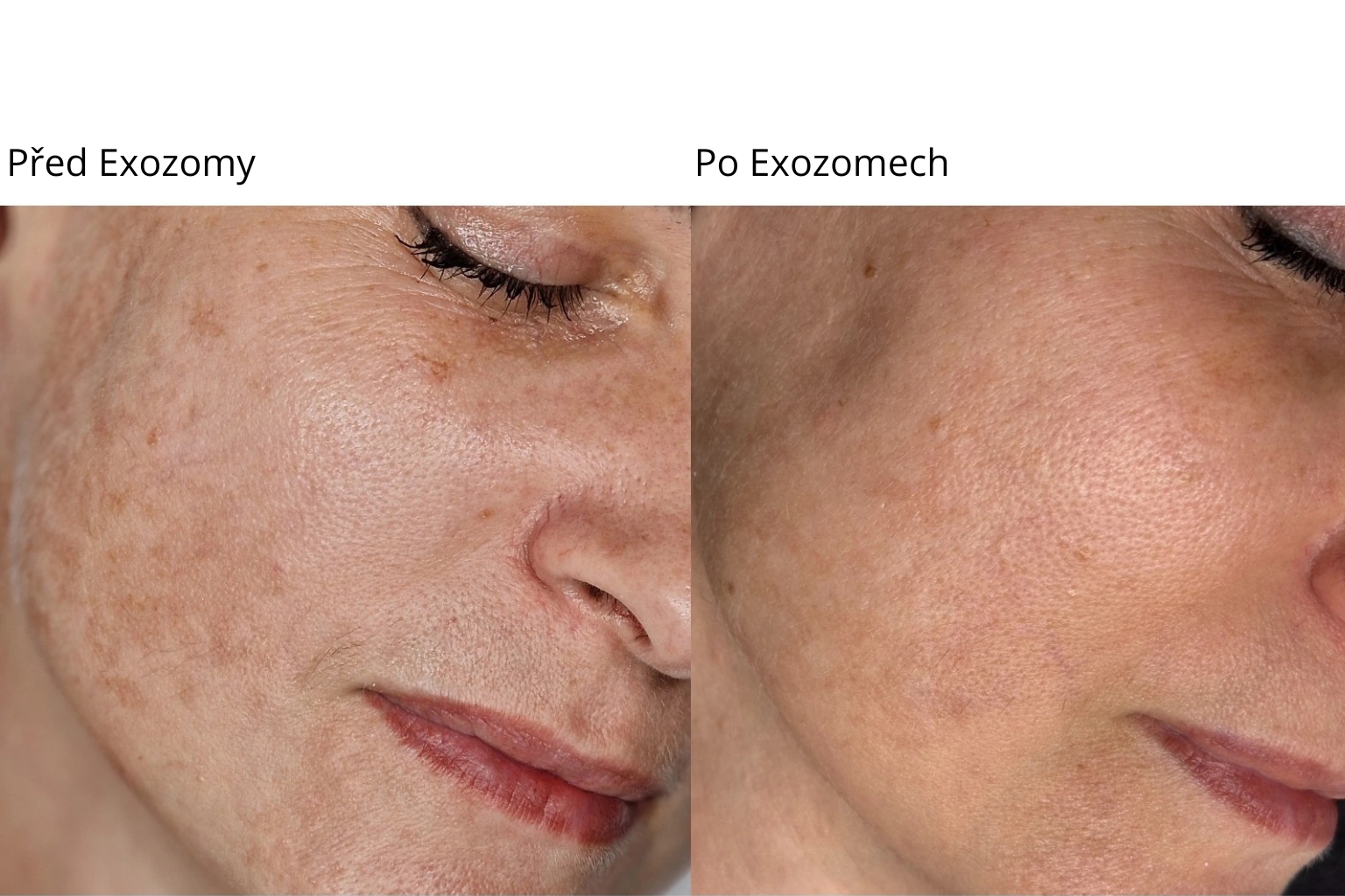 Exozomy v regenerativní kosmetice. Proč o nich všichni mluví?