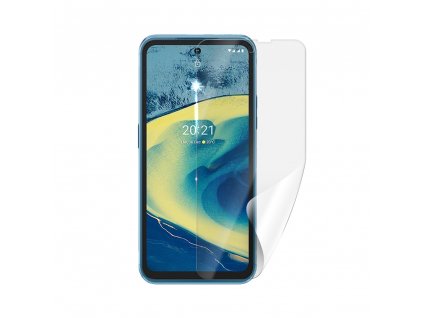 Screenshield NOKIA XR20 5G fólie na displej NOK-XR205G-D