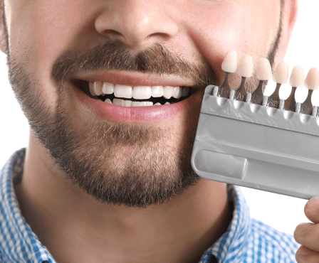 Jak často je vhodné bělit zuby