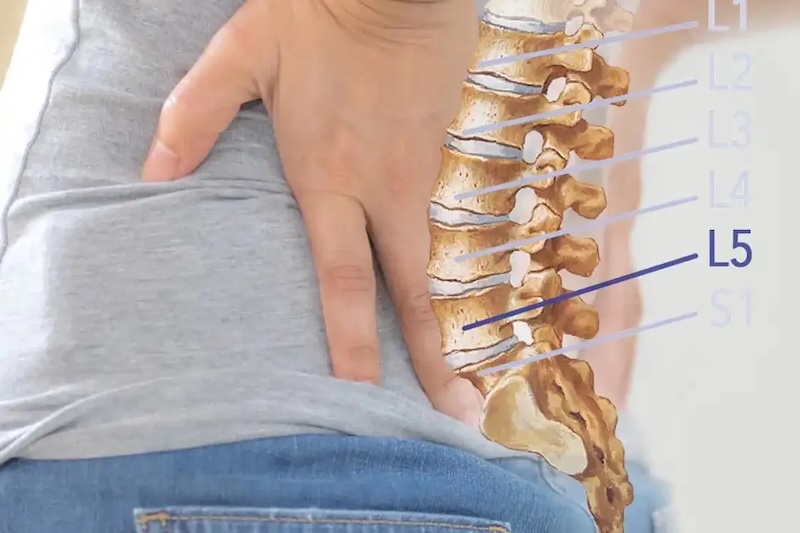 Pochopte dve úrovne chrbtice, ktoré môžu spôsobovať bolesť chrbta