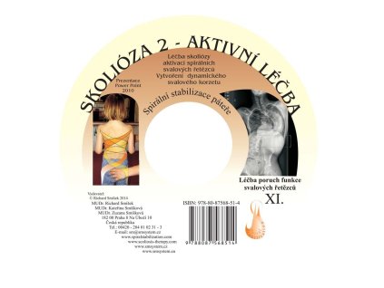USB Skolióza 2- aktívna liečba