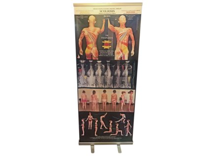 Roll-up banner- Skolióza