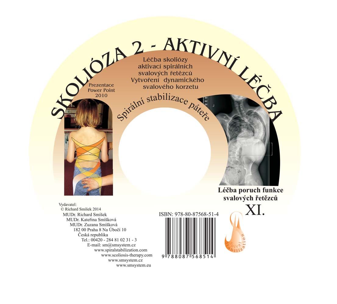SM systém USB Skolióza 2- aktívna liečba