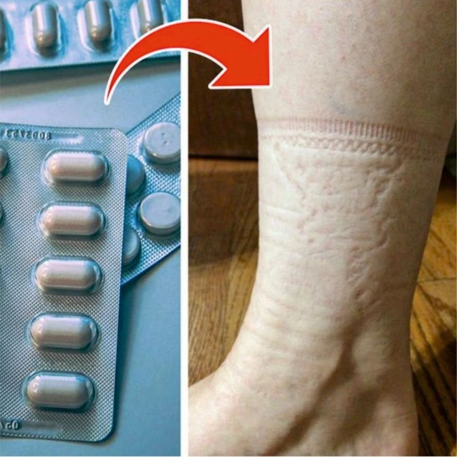 Diabetik?  Ako zostať zdravý začína nohami!