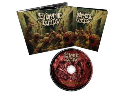 CDGmasdp1532