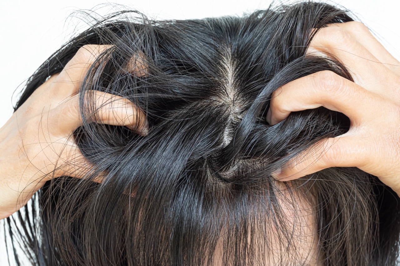 Svědění vlasové pokožky: co ho způsobuje a jak o pokožku správně pečovat