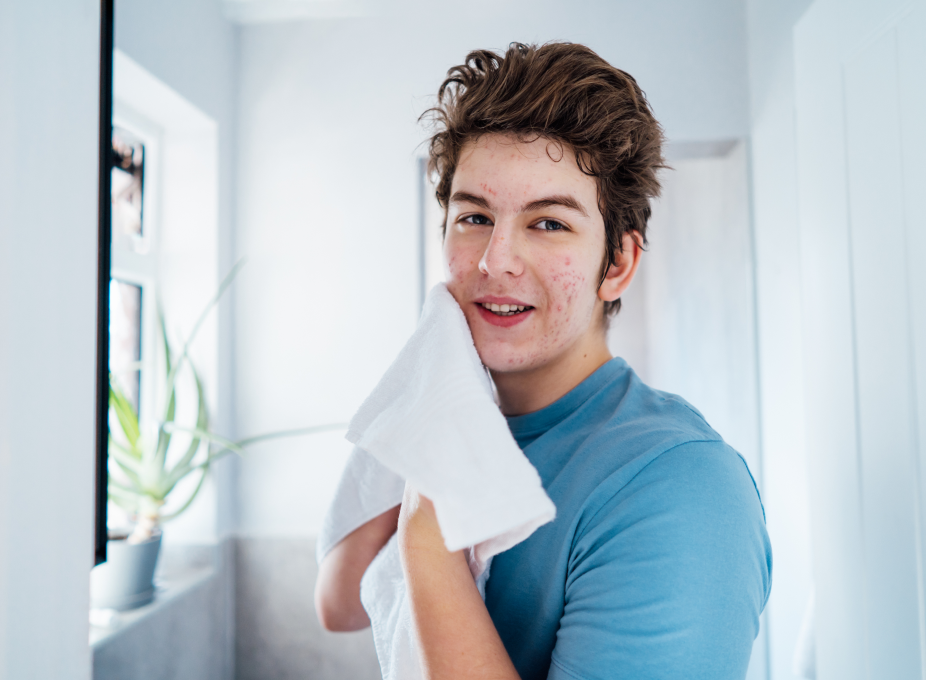 Teenage care for very sensitive skin