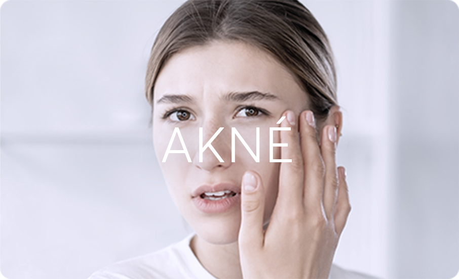 Akné