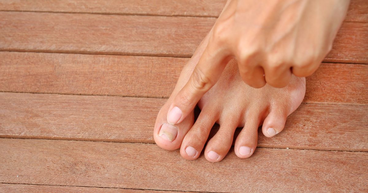 Trápí vás zarůstající nehet? Objevte tajemství, jak se ho zbavit jednou provždy!
