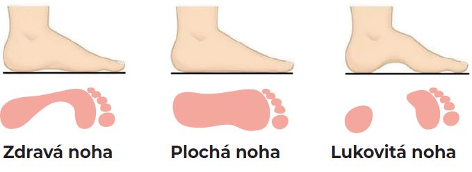 plocha_noha