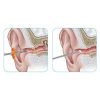 Earpick - Tyčinka na čištění uší 2v1  Tyčinka na čištění uší 2v1