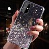 Kryt Xiaomi Mi 11 Sequins Glue Glitter Case černý