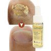 vyrp12 11604serum3
