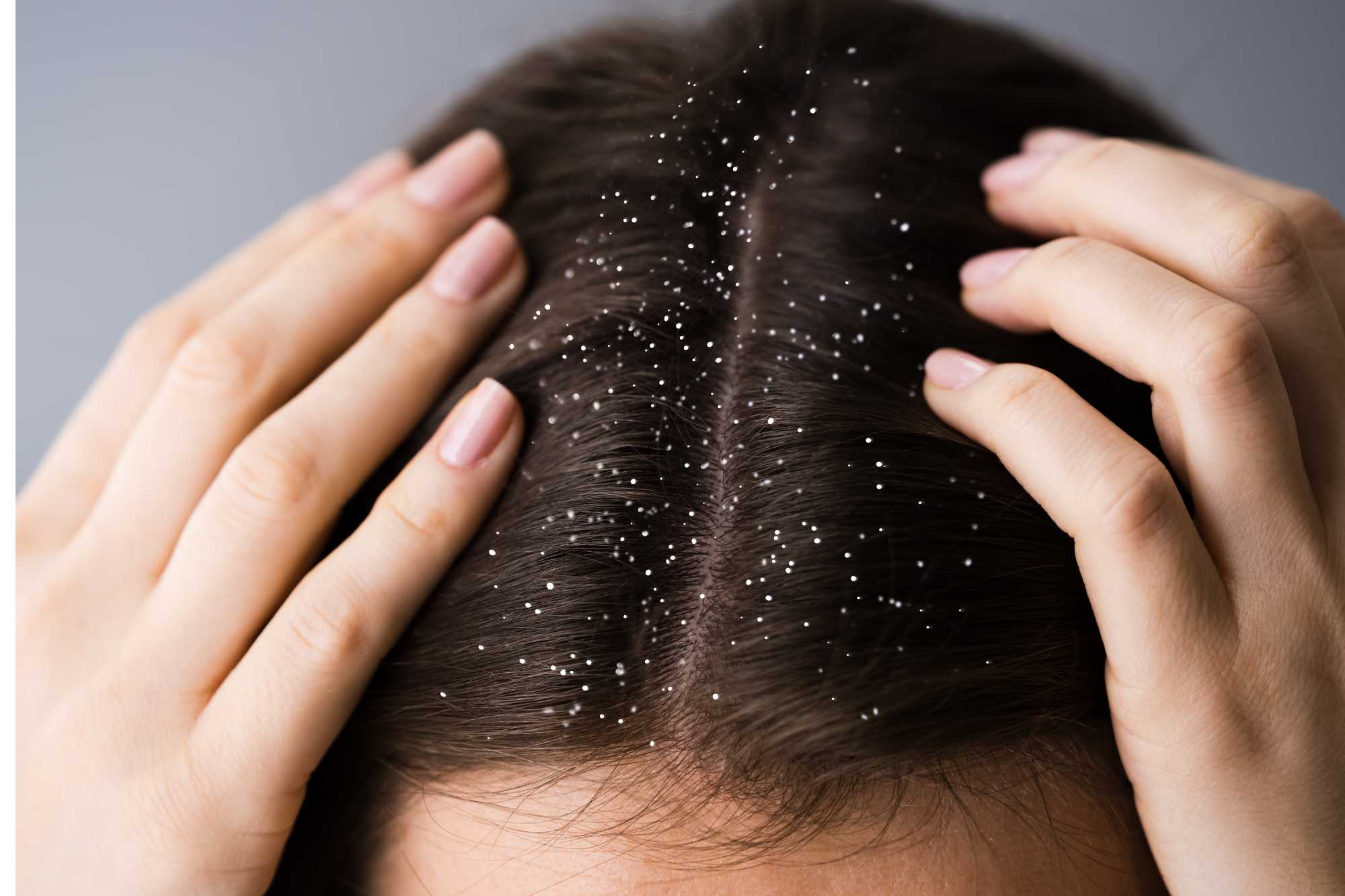 Suche lupiny vo vlasoch