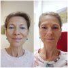 Samoopaľovací krém na tvár Sunkissed face cream | SUNSAN
