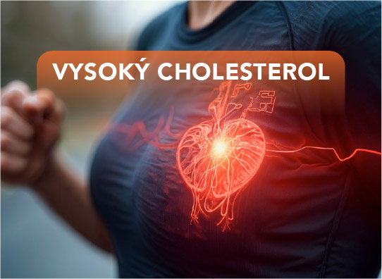 Vysoký cholesterol? Je nebezpečný?