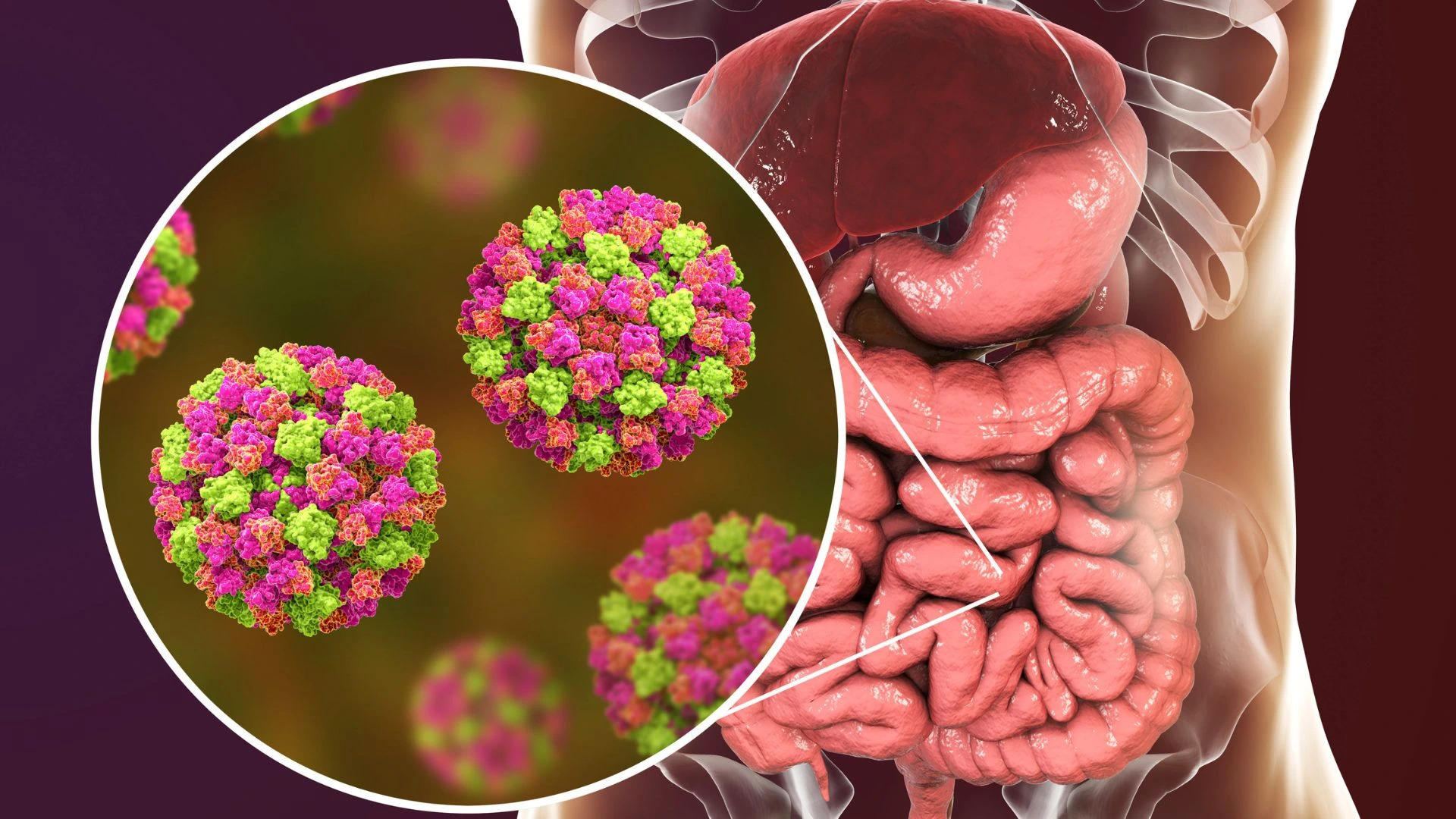 Postihla vás střevní viróza? Takto s ní zatočíte!