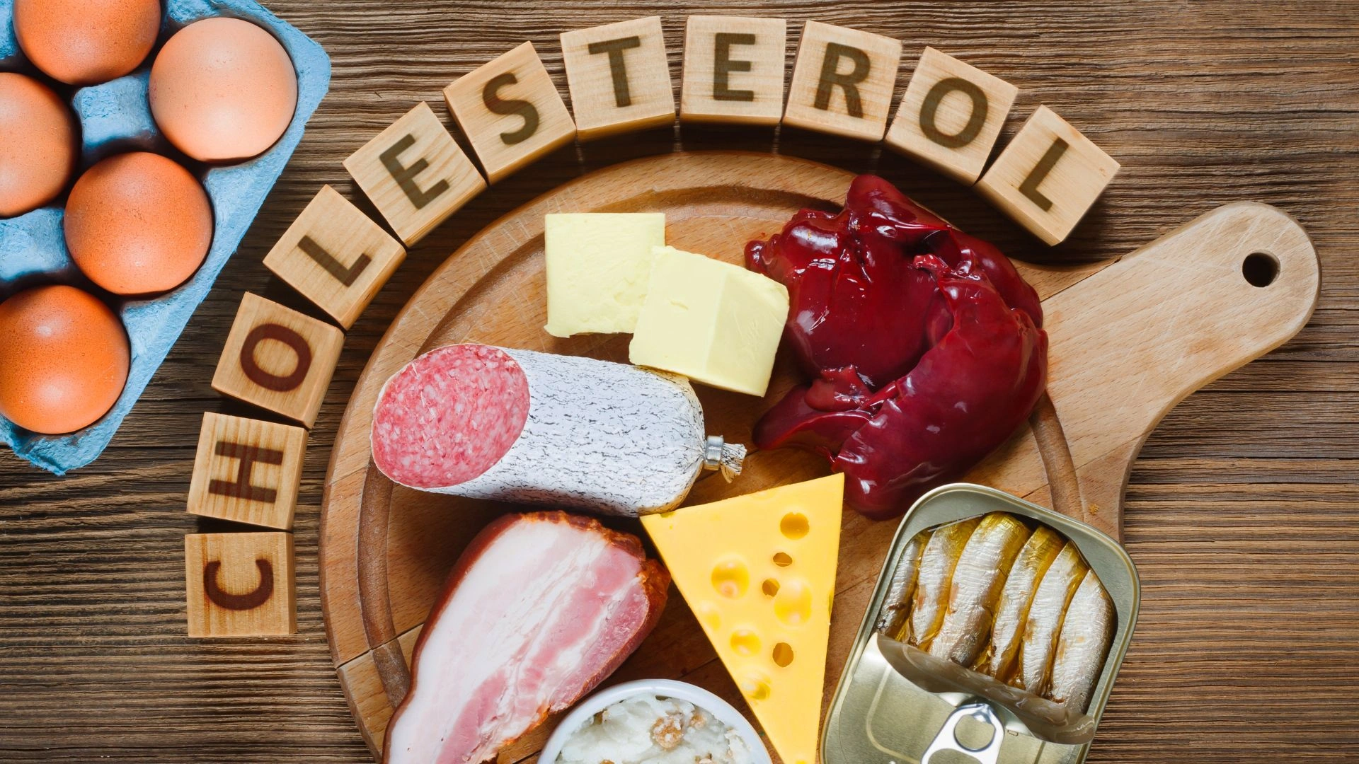 Máte vysoký cholesterol? Takto upravíte jeho hladinu!