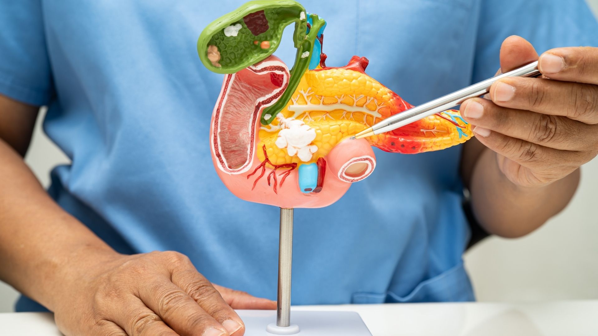 Rakovina pankreasu: Ako odhaliť príznaky včas?