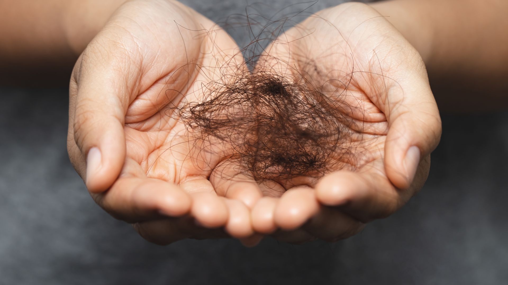 Vypadávanie vlasov môže byť frustrujúce: Ako proti nemu účinne bojovať?