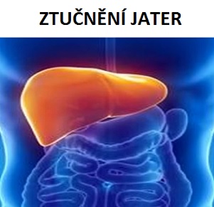 Tučná játra