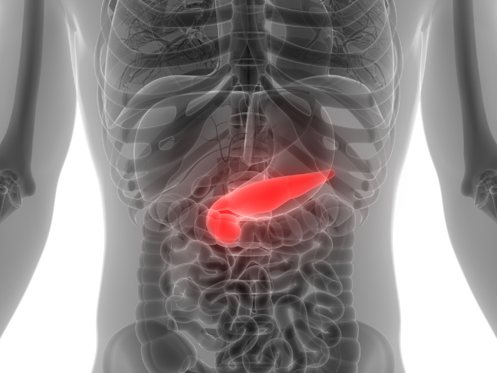 Krystaly a zánět slinivky břišní