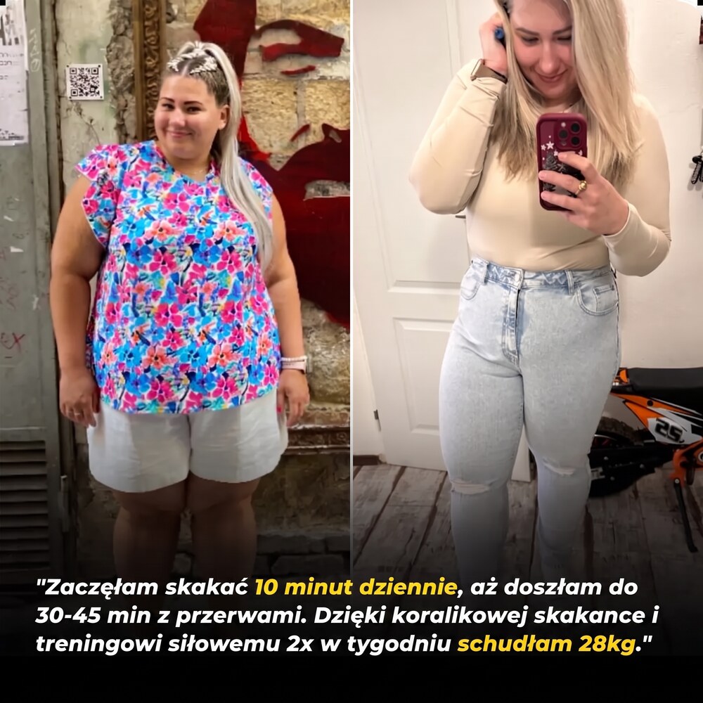 Przemiana Šviháka – kobieta schudła 28 kg dzięki skakaniu na skakance 10 minut dziennie i skakance z koralikami Švihej