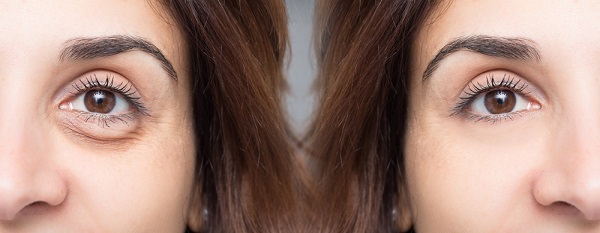 Objevte sílu peptidů v kosmetice