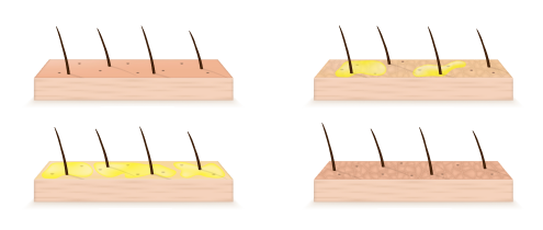 Zjistěte, jaký typ pleti máte [TEST]