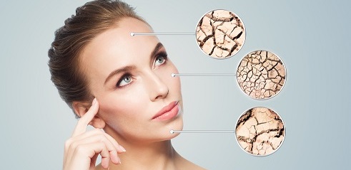 Trápí vás suchá pleť? Poradíme vám