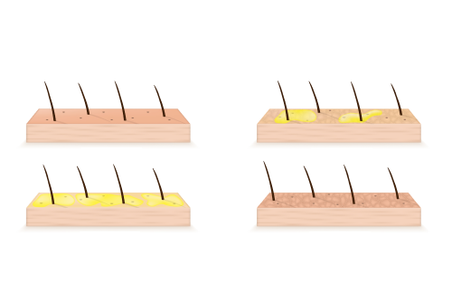 Zjistěte, jaký typ pleti máte [TEST]