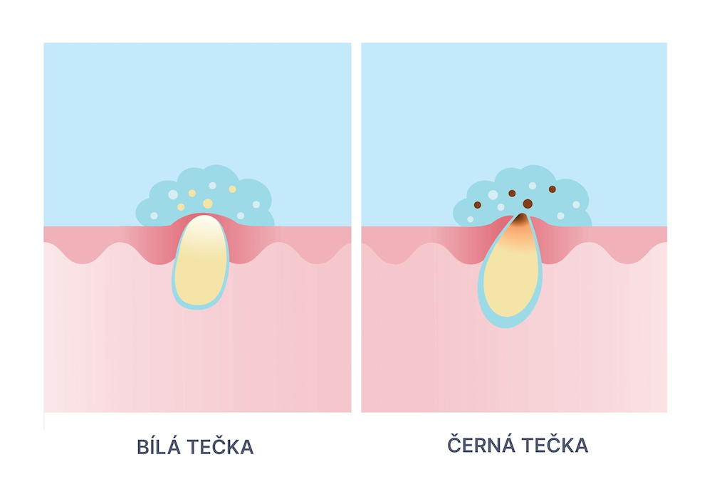 bila-cerna-tecka