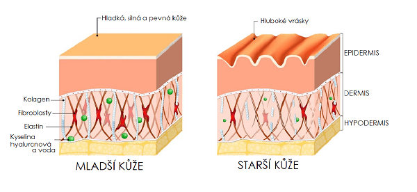 mladsi-vs-starsi-kuze_vrásky