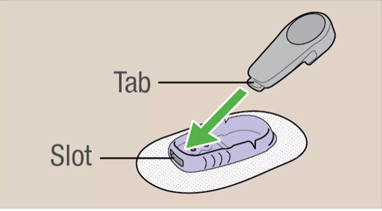 Dexcom_G6__vysielac_4