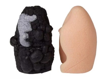 R10063 - Egészséges és dohányos tüdő modell