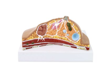 GD02541 - Női mellmodell betegségekkel