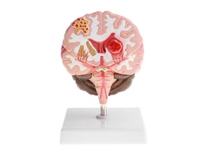 GD0250047 - Agymodell betegségekkel