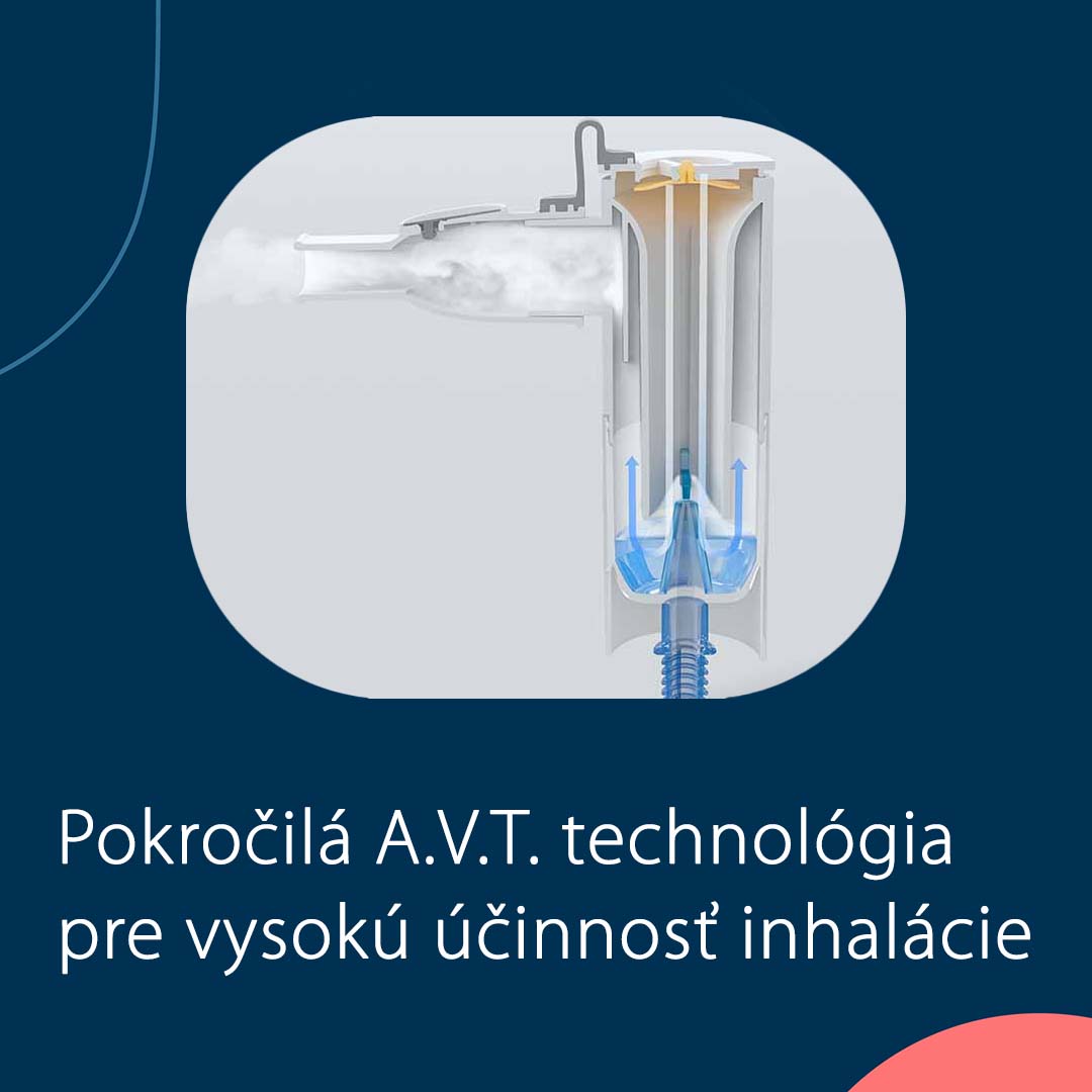 Pokročilá AVT technológia