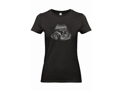 Dámske čierne tričko s ultrazvukom