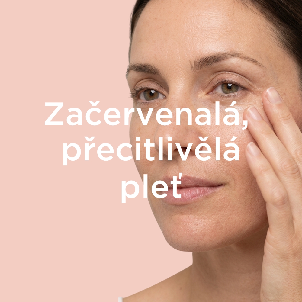 ZAČERVENALÁ, PŘECITLIVĚLÁ PLEŤ