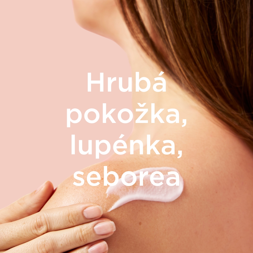 HRUBÁ POKOŽKA, LUPÉNKA, SEBOREA