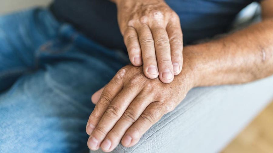 10 přírodních prostředků na pomoc při artritidě rukou