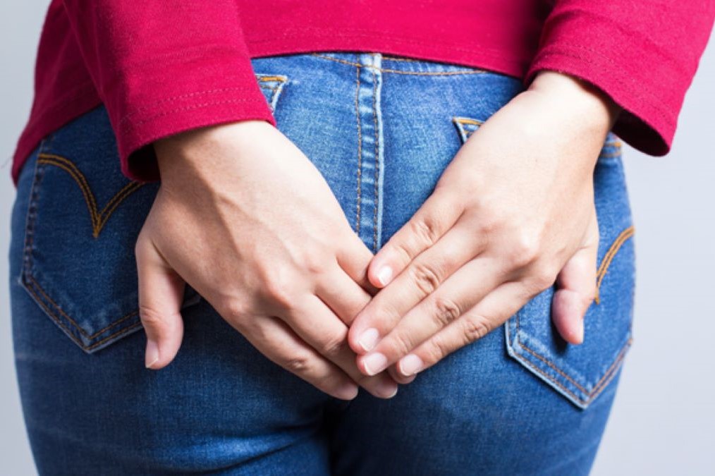 Hemoroidy - příznaky, příčiny a léčba.